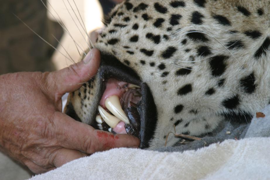 Checking of Teeth